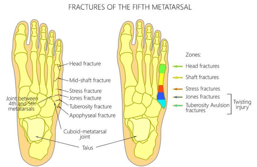 Same day appointment  River Podiatry I The Best Foot and Ankle Care in  NYNJ